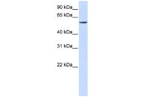 WB Suggested Anti-ZNF358 Antibody Titration: 0. (ZNF358 Antikörper  (C-Term))