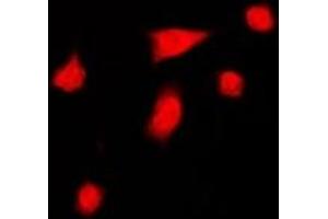 Immunofluorescent analysis of DGK iota staining in HeLa cells.