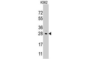 Western blot analysis of LIN28B polyclonal antibody  in K-562 cell line lysates (35 ug/lane). (LIN28B Antikörper  (Internal Region))