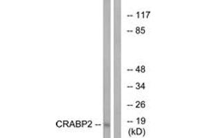 Western blot analysis of extracts from HT-29 cells, using CRABP2 Antibody.