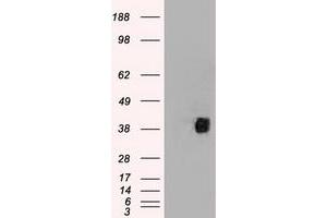 HEK293T cells were transfected with the pCMV6-ENTRY control (Left lane) or pCMV6-ENTRY CD2 (Right lane) cDNA for 48 hrs and lysed. (CD2 Antikörper)