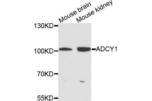 Western blot analysis of extracts of various cells, using ADCY1 antibody. (ADCY1 Antikörper)