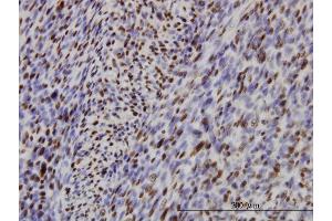 Immunostaining (ISt) image for anti-Interferon Regulatory Factor 2 (IRF2) (AA 216-315) antibody (ABIN561522)