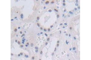 Figure. (NFIB Antikörper  (AA 1-233))