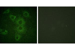 Peptide - +Immunofluorescence analysis of HuvEc cells, using BIK (Ab-33) antibody (#B0053). (BIK Antikörper  (Thr33))