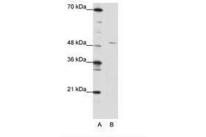 Image no. 1 for anti-High-Mobility Group 20A (HMG20A) (AA 181-230) antibody (ABIN202299) (HMG20A Antikörper  (AA 181-230))