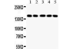 Anti- COL2A1 antibody, Western blotting All lanes: Anti COL2A1  at 0.