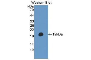 Western blot analysis of the recombinant protein. (TSC22D3 Antikörper  (AA 1-137))