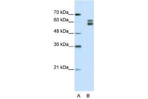 MSH2 antibody used at 1. (MSH2 Antikörper)