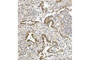 IHC analysis of PVRL1/NECTIN1 using anti-PVRL1/NECTIN1 antibody (ABIN7601298).