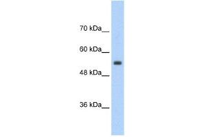 WB Suggested Anti-SLC13A3 Antibody Titration:  2. (SLC13A3 Antikörper  (Middle Region))