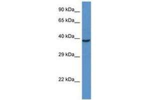 Image no. 1 for anti-RAD51 Homolog D (RAD51D) (C-Term) antibody (ABIN6747399) (RAD51D Antikörper  (C-Term))