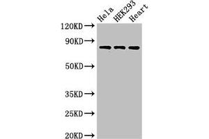 Western Blot Positive WB detected in: Hela whole cell lysate, HEK293 whole cell lysate, Rat heart tissue All lanes: C1R antibody at 3 μg/mL Secondary Goat polyclonal to rabbit IgG at 1/50000 dilution Predicted band size: 81 kDa Observed band size: 81 kDa (C1R Antikörper  (AA 65-192))