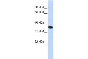 WB Suggested Anti-C21orf59  Antibody Titration: 0. (C21orf59 Antikörper  (N-Term))