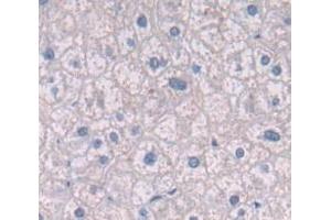 Figure. (Integrin beta 4 Antikörper  (AA 923-1197))