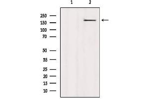 Western blot analysis of extracts from HepG2, using CAMSAP2 Antibody. (CAMSAP2 Antikörper  (C-Term))