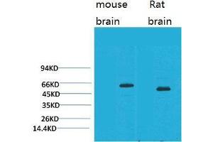Western Blot (WB) analysis of 1) Mouse Brain Tissue, 2)Rat Brain Tissue with EAAT2 Rabbit Polyclonal Antibody diluted at 1:2000. (SLC1A2 Antikörper)