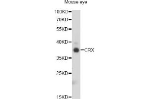Western blot analysis of extracts of mouse eye, using CRX antibody (ABIN2562021) at 1:1000 dilution. (CRX Antikörper)