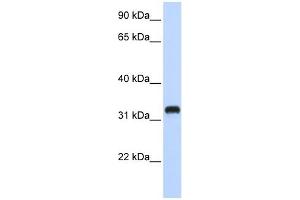 C21ORF62 antibody used at 1 ug/ml to detect target protein. (C21orf62 Antikörper  (Middle Region))