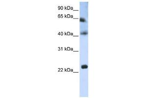 Tetraspanin 3 antibody used at 1 ug/ml to detect target protein. (Tetraspanin 3 Antikörper  (Middle Region))