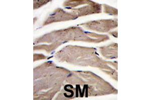 Formalin-fixed and paraffin-embedded human skeletal muscle reacted with PFKM polyclonal antibody  , which was peroxidase-conjugated to the secondary antibody, followed by DAB staining. (PFKM Antikörper  (C-Term))