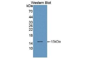 Detection of Recombinant ACYP1, Human using Polyclonal Antibody to Acylphosphatase 1, Erythrocyte (ACYP1) (Acylphosphatase 1, Erythrocyte (AA 1-99) Antikörper)