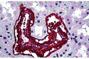 Human Kidney: Formalin-Fixed, Paraffin-Embedded (FFPE) (Inhibin alpha Antikörper)