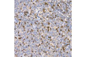 Immunohistochemistry of paraffin-embedded human tonsil using LTBR Rabbit pAb (ABIN6129412, ABIN6143379, ABIN6143381 and ABIN6220987) at dilution of 1:25 (40x lens). (LTBR Antikörper  (AA 31-227))