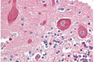 Human Brain, Cerebellum (formalin-fixed, paraffin-embedded) stained with MAP2K1 antibody ABIN461964 at 10 ug/ml followed by biotinylated goat anti-rabbit IgG secondary antibody ABIN481713, alkaline phosphatase-streptavidin and chromogen. (MEK1 Antikörper  (N-Term))