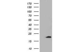 Western Blotting (WB) image for anti-Acireductone Dioxygenase 1 (ADI1) antibody (ABIN1496483) (ADI1 Antikörper)