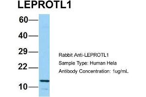 Host: Rabbit Target Name: LEPROTL1 Sample Type: Human Hela Antibody Dilution: 1. (LEPROTL1 Antikörper  (N-Term))