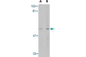 Western blot analysis of LGI4 in rat brain tissue lysate with LGI4 polyclonal antibody  at (A) 1 and (B) 2 ug/mL . (LGI4 Antikörper  (C-Term))