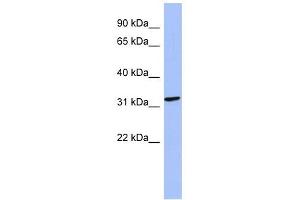 MAGEB2 antibody used at 1 ug/ml to detect target protein. (MAGEB2 Antikörper  (N-Term))