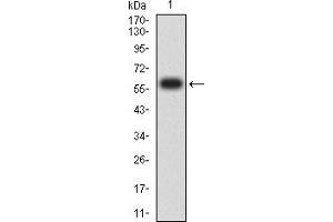 Western blot analysis using CD172G mAb against human CD172G (AA: extra 29-360) recombinant protein. (SIRPG Antikörper  (AA 29-360))
