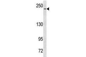 NOTCH3 antibody western blot analysis in HeLa lysate. (NOTCH3 Antikörper  (AA 2291-2321))