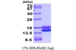 SDS-PAGE (SDS) image for Cystatin C (CST3) (AA 21-140) (Active) protein (His tag) (ABIN5854530)