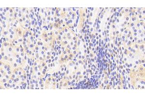Detection of APPBP1 in Human Kidney Tissue using Polyclonal Antibody to Amyloid Beta Precursor Protein Binding Protein 1 (APPBP1) (NAE1 Antikörper  (AA 229-534))