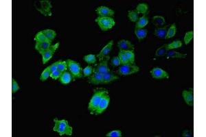 Immunofluorescence staining of HepG2 cells with ABIN7142083 at 1:200, counter-stained with DAPI. (YWHAB Antikörper  (AA 1-246))