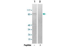 Western blot analysis of extracts from K-562 cells, using TACC1 polyclonal antibody . (TACC1 Antikörper  (N-Term))