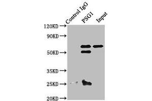 Immunoprecipitating PSG1 in A549 whole cell lysate Lane 1: Rabbit control IgG instead of ABIN7164230 in A549 whole cell lysate.