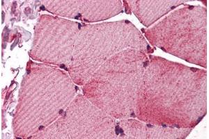 Human Skeletal Muscle: Formalin-Fixed, Paraffin-Embedded (FFPE) (Fukutin Antikörper  (AA 272-456))