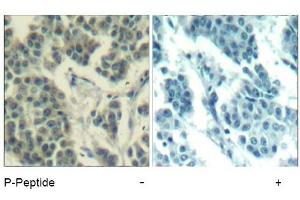 Image no. 3 for anti-Receptor Tyrosine-Protein Kinase ErbB-3 (ERBB3) (pTyr1328) antibody (ABIN319273) (ERBB3 Antikörper  (pTyr1328))