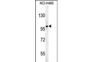 ST18 Antibody (N-term) (ABIN651571 and ABIN2840307) western blot analysis in NCI- cell line lysates (35 μg/lane).