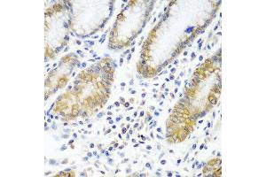 Immunohistochemistry of paraffin-embedded human stomach using ATAD3A antibody at dilution of 1:100 (40x lens).