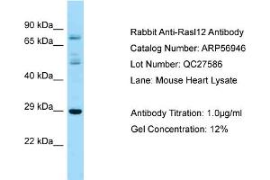 Western Blotting (WB) image for anti-RAS-Like, Family 12 (RASL12) (N-Term) antibody (ABIN2786986) (RASL12 Antikörper  (N-Term))