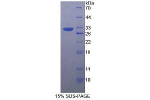 SDS-PAGE (SDS) image for Tubulin, beta (TUBB) (AA 170-419) protein (His tag) (ABIN2127108)