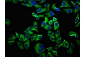 Immunofluorescence staining of Hela cells with ABIN7161187 at 1:100, counter-stained with DAPI. (UNC5D Antikörper  (AA 90-212))