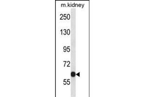 KCNC2 Antibody (C-term) (ABIN657792 and ABIN2846765) western blot analysis in mouse kidney tissue lysates (35 μg/lane).