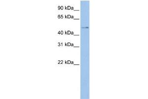 WB Suggested Anti-TSPYL4  Antibody Titration: 0.