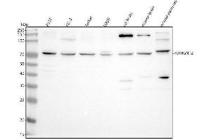 Western blot analysis of POMGNT2 using anti-POMGNT2 antibody (ABIN7601645).